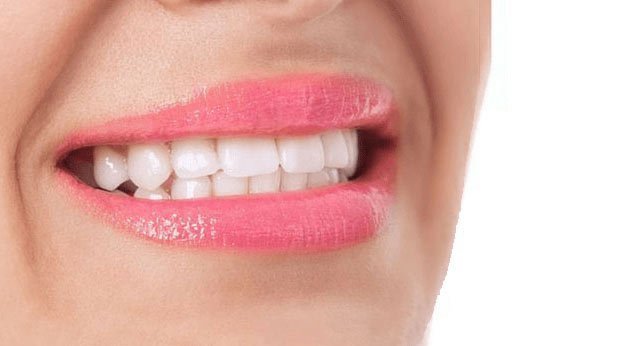 ankara_ortodonti_poliklinigi_BEFORE