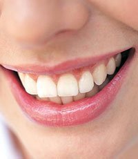 ankaraortodonti_poliklinigi